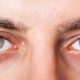 ¿Qué es un derrame ocular?