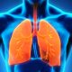 Todo sobre la enfermedad pulmonar obstructiva crónica (EPOC)