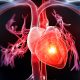 Cardiopatía coronaria: causas, síntomas, tratamientos