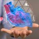 Múltiples métodos de cardiología intervencional contra las enfermedades coronarias