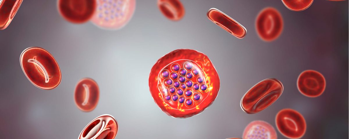 Filtración para-valvular ocasionaría la destrucción de los glóbulos rojos